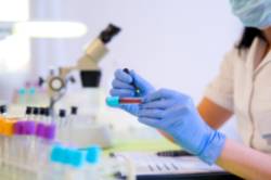 2024 09 19 Septiembre cáncer hematológico (2)